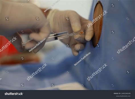 Anesthesiologist Performing Spinal Anesthesia His Patient Stock Photo 2493246169 | Shutterstock