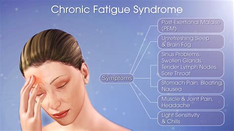 Chronic Fatigue Syndrome