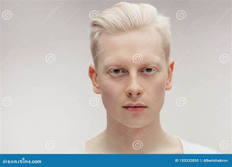 Albinism In Humans Model