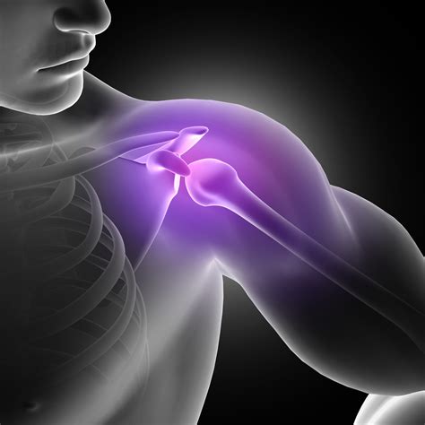 AC Joint Sprain | Agape Health