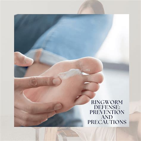 Ringworm Unveiled: Diagnosis and Effective Treatment Explained | Clinikally