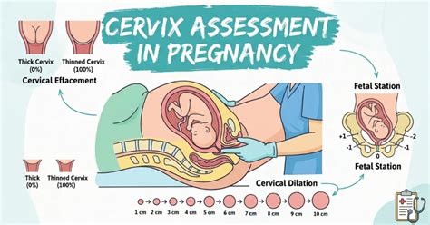 Cervix Assessment in Pregnancy: Understanding Effacement and Dilation ...