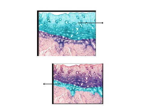 Endometrium- histology Quiz