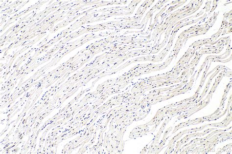 Lamin B1 antibody (12987-1-AP) | Proteintech