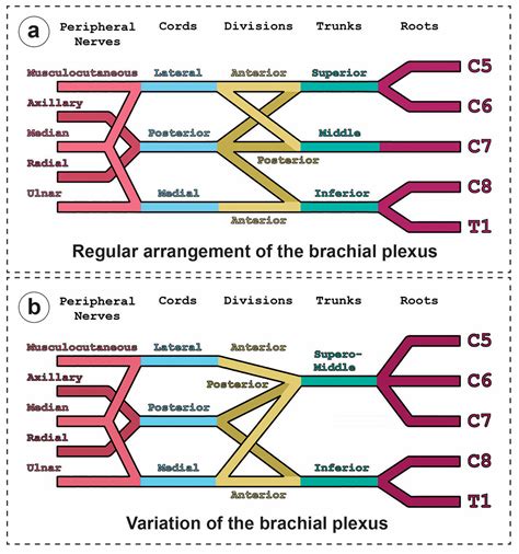 Rare Superior and Middle Trunk Fusion Accompanied by Altered Division ...
