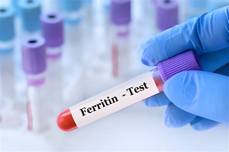 Normal Ferritin Levels Chart for Women: Age-Wise Essential Ferritin Ranges for Female Wellbeing