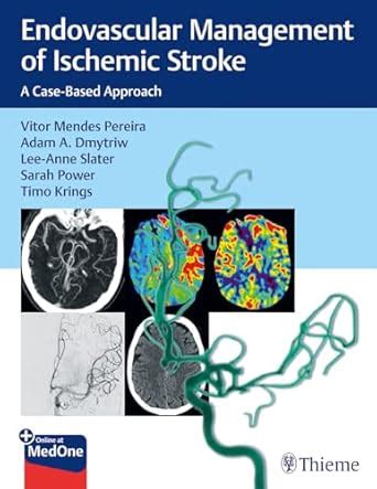 Buy Endovascular Management of Ischemic Stroke: A Case-Based Approach ...