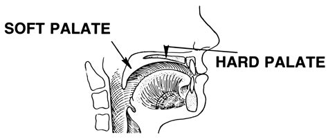 Hard And Soft Palate Diagram