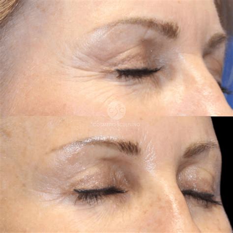 Image result for Microcurrent LED Light