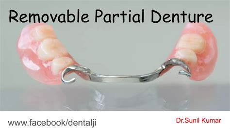 Removable partial denture introduction (part 1) | PDF