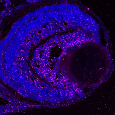 HSP27 antibody (66767-1-Ig) | Proteintech
