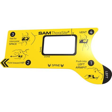 Needle Decompression