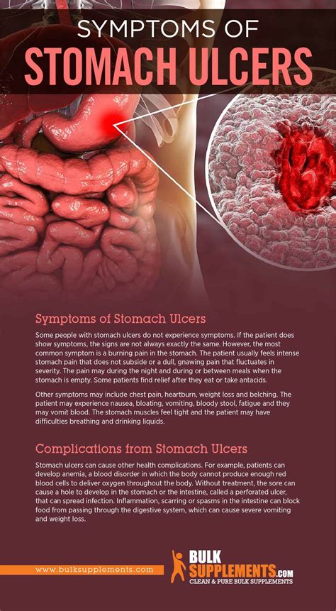 Stomach Ulcers: Causes, Symptoms, and Treatment