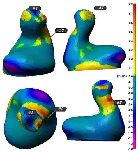 Custom-Fitted In- and Around-the-Ear Sensors for Unobtrusive and On-the ...
