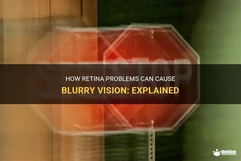 Image result for Visual Problems