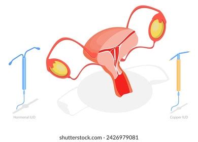 Image result for UID Family Planning