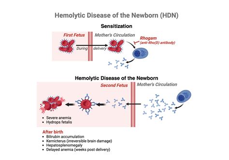 Hemolytic Disease of the Newborn (HDN) | BioRender Science Templates