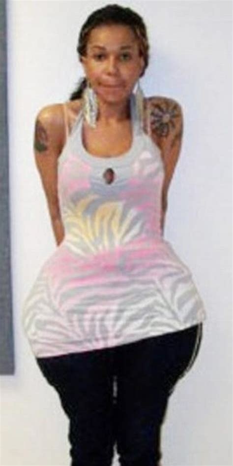 Fake Doctor Oneal Ron Morris: Woman Says Her Face Was Deformed After ...