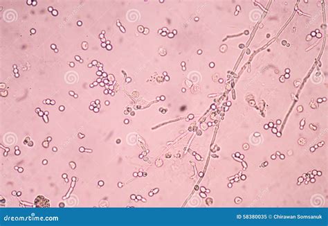 Budding Yeast Cells with Pseudohyphae Stock Image - Image of pathology ...