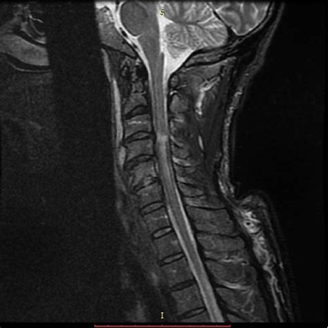 Image result for Normal Profile CT