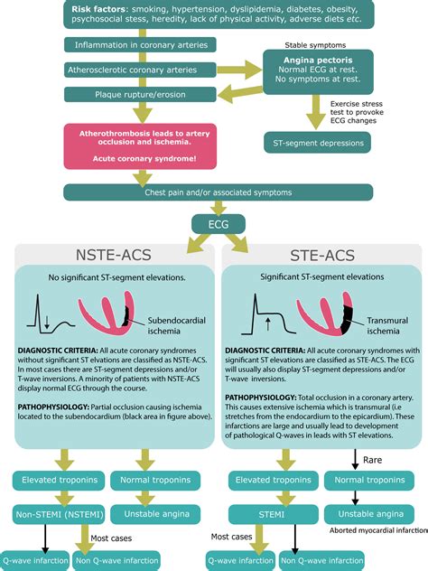 NSTEMI (Non ST Elevation Myocardial Infarction) & Unstable Angina: Diagnosis, Criteria, ECG ...