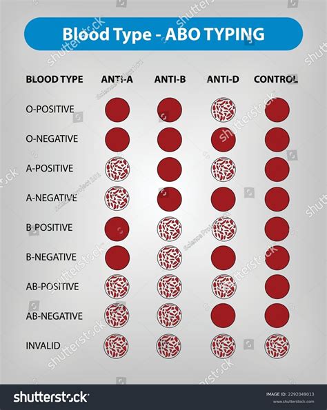 Blood Type Abo Typing Vector Illustration Stock Vector (Royalty Free) 2292049013 | Shutterstock