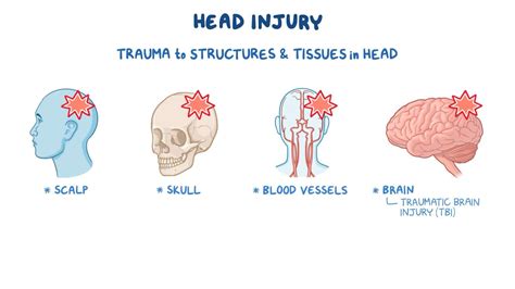 Video: Head injury: Nursing | Osmosis