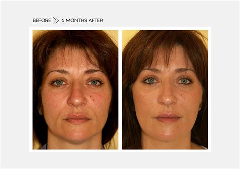 Spring Thread 的图像结果