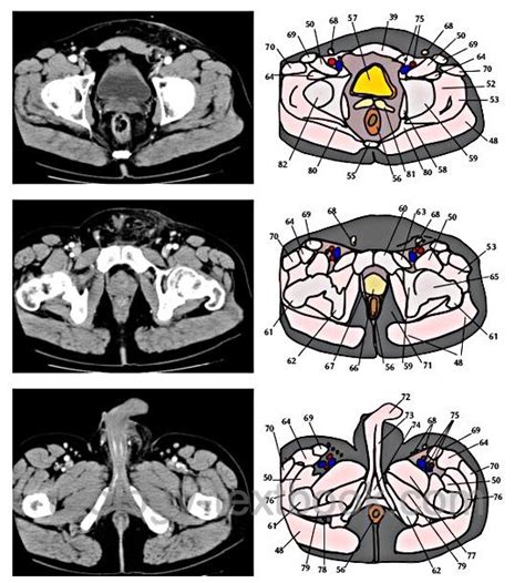 CT Scan 的图像结果