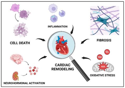 Life | Special Issue : Ischemic Heart Disease in the Context of ...
