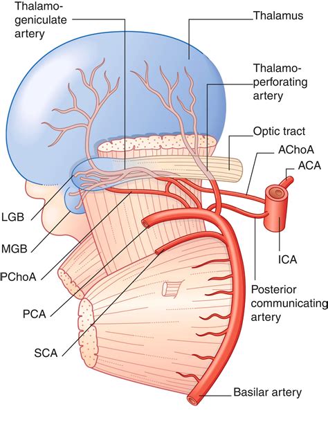Cerebrovascular Disease - Clinical Tree