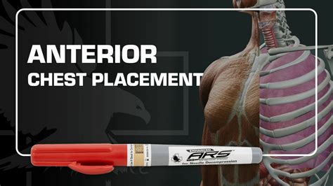 Anterior Chest Placement for the Second Intercostal Space When ...