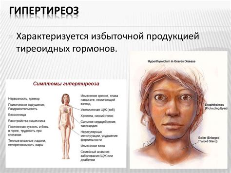 Гиперфункция болезни