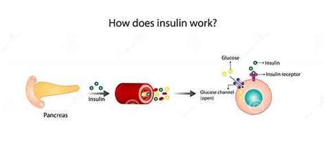 Image result for Insulin Management Algorithm