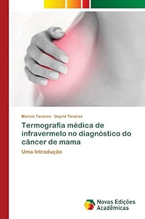 Buy Termografia médica de infravermelo no diagnóstico do câncer de mama ...