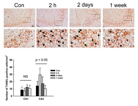 Identification of Brain Damage after Seizures Using an MR-Based ...