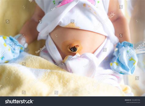 86 Umbilical cord stump 图片、库存照片和矢量图 | Shutterstock