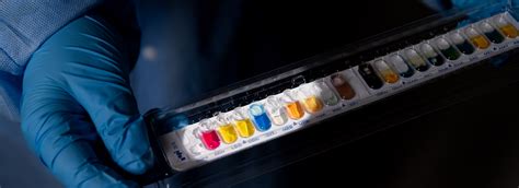 Image result for MLT Lab Week