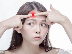 Image result for 痘痘 ACNE