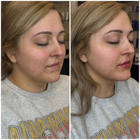 Graceful Beauty Aesthetics | Ohio Med Spa (@gracefulbeauty_aesthetics ...