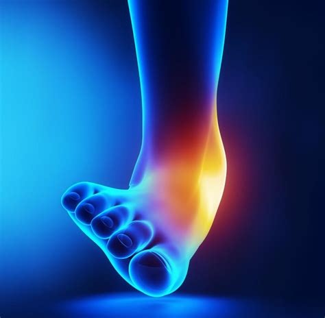 How to Avoid an Ankle Sprain: South Sound Foot & Ankle: Podiatric ...