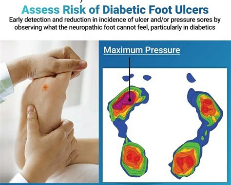 Foot and Posture Analysis Training Seawoods Ivory Physiotherapy