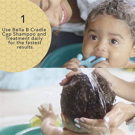 Cradle Cap Black Babies