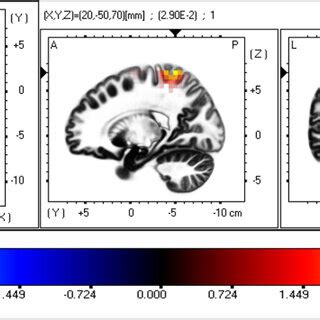 Image result for EEG Source Localization