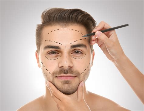Plastic Surgery Before And After Men Face