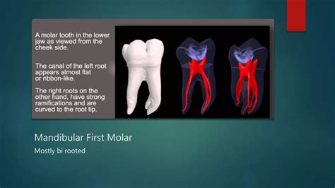 Mandibular first molar pulp canal morphology | PPTX