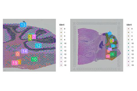 Spatial Transcriptome Root 的图像结果
