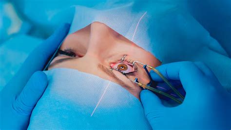 Bollywood Veteran Dharmendra Undergoes Corneal Transplantation ...