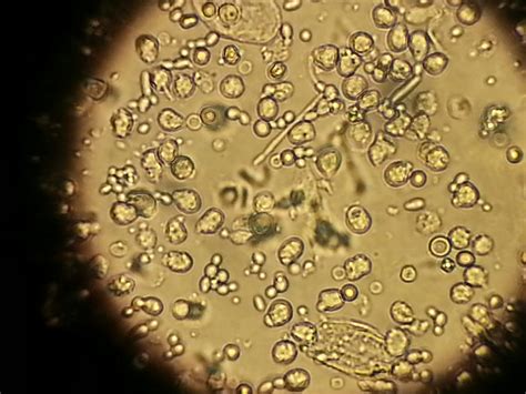 Yeast Budding In Urine