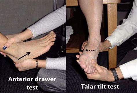 Posterior Drawer Test Ankle